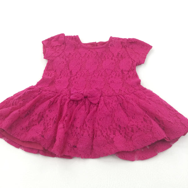 Flowers Lacey Overlay Hot Pink Jersey Dress - Girls 3-6 Months