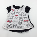 Glittery Bows Black & White Tunic Top - Girls 3-6 Months